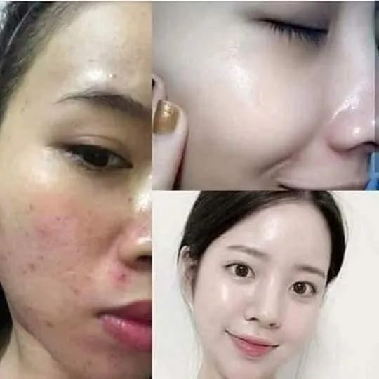Dr. Yanhee Anti-Aging Facial Set - Purple/Pink set