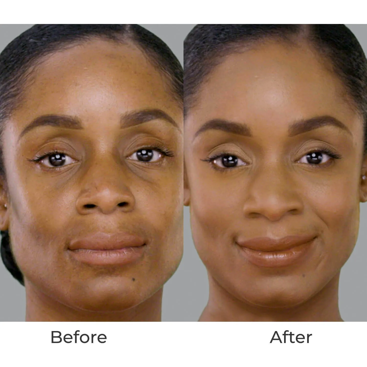 Starter Kit Silk 4-in-1 Advanced